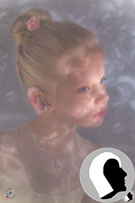 CI Kopf 2018 weiblich Kind